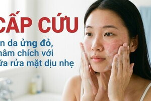 "Cấp cứu" làn da ửng đỏ, châm chích với sữa rửa mặt dịu nhẹ