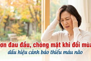 Cơn đau đầu, chóng mặt khi đổi mùa: dấu hiệu cảnh báo thiếu máu não