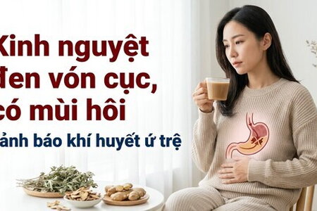 Kinh nguyệt đen vón cục, có mùi hôi: cảnh báo khí huyết ứ trệ
