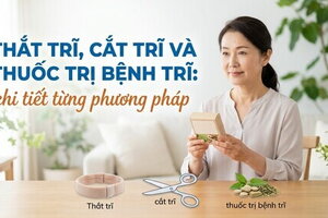 Thắt trĩ, cắt trĩ và thuốc trị bệnh trĩ: chi tiết từng phương pháp