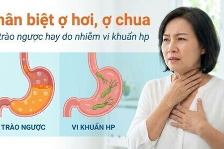 Phân biệt ợ hơi, ợ chua do trào ngược hay do nhiễm vi khuẩn hp