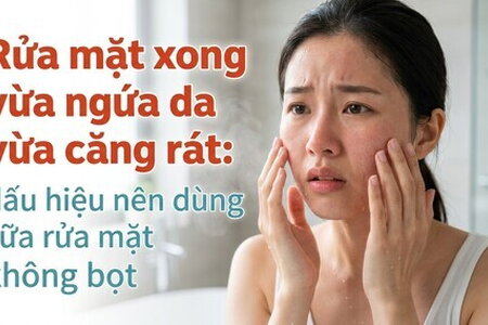 Rửa mặt xong vừa ngứa da vừa căng rát: nên dùng sữa rửa mặt không bọt
