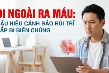 Đi ngoài ra máu: dấu hiệu cảnh báo búi trĩ sắp bị biến chứng
