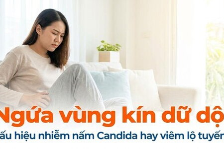 Ngứa vùng kín dữ dội - dấu hiệu nhiễm nấm Candida hay viêm lộ tuyến?