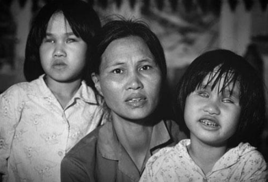 Ngày 10/8 - 'Vì nạn nhân chất độc da cam Việt Nam'